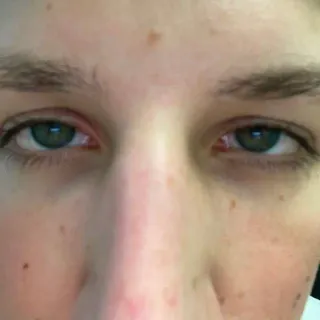 👀 face, eyes, nose, portrait, human, close-up telegram sticker