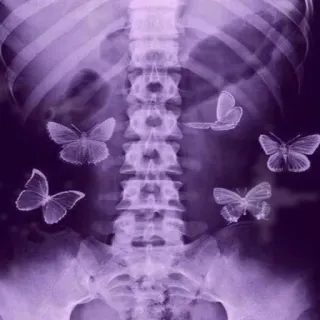 ❤️ x-ray, butterflies, abdomen, purple, internal, anatomy, body telegram sticker