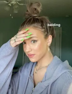 💕 balding Glatze, Haare, Schönheit, Frau, Porträt telegram sticker