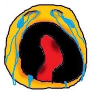 😭 triste, piangere, emoji, emotivo, lacrime telegram sticker