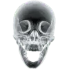 🩻