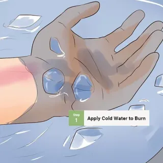 🔥 Apply Cold Water to Burn burns, first aid, emergency, cold water, health, safety telegram sticker