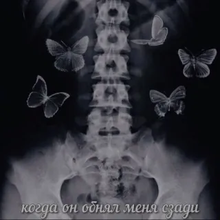 🙊 когда он обнял меня сзади Raggi X, Colonna vertebrale, Farfalle, Russo, Testo, Corpo, Arte telegram sticker