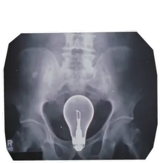 💡 x-ray, light bulb, medical, pelvis, anatomy, radiology telegram sticker