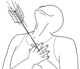 😩 arrow, injury, neck, hurt, wound, ouch, pain, injured telegram sticker