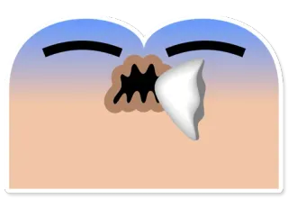 🤧 telegram sticker
