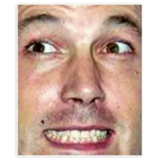 😬 54c1a22a 脸, 傻, 眼睛, 表情 telegram sticker