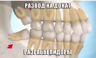 🌟 7e2e0a26 РАЗВОД НА ДОНАТ
РАЗРАБЫ ПИДОРЫ teeth, anatomy, offensive language, Russian, slur whatsapp sticker