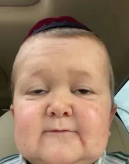 🙄 76ed5d82 Hasbulla Magomedov Hasbulla, Mini Khabib, Osobowość medialna, Rosyjski Bloger telegram sticker