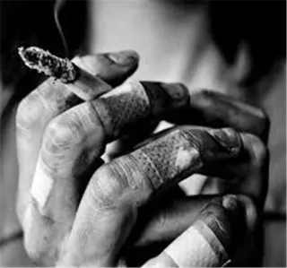 🚬 df4f8c4d sigaret, roken, handen, verband, zwart wit, verwonding telegram sticker
