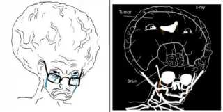 🤔 01d4131a мозг, мем, опухоль, рентген, плач, большой мозг telegram sticker