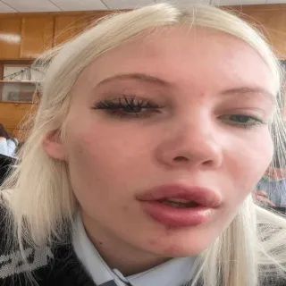 🥴 8cd792d1 telegram sticker